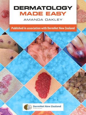 cover image of Dermatology Made Easy